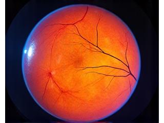 Image OCT (Tomographie en Cohérence Optique) de la rétine.