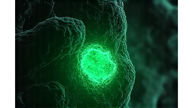 Images de cellules cancéreuses avec marquage IA pour la détection de tumeurs et le staging automatique.